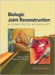 Biologic Joint Reconstruction Alternatives to Joint Arthroplasty 