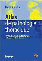 Atlas de pathologie thoracique, (2287484914), Anthoine, Textbooks 