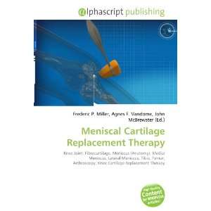    Meniscal Cartilage Replacement Therapy (9786134090612) Books