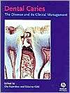 Dental Caries The Disease and Its Clinical Management, (1405107189 