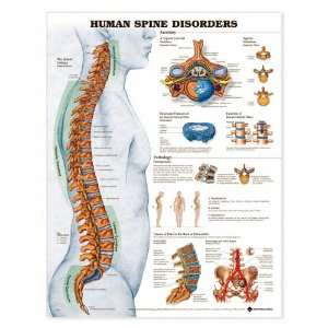 Human Spine Disorders Anatomical Chart Unmounted 9970PU  